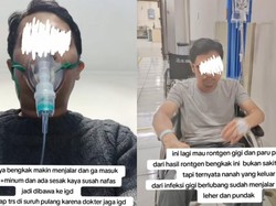 Kata Dokter Soal Viral Pria di Bandung Meninggal Usai Alami Gigi Berlubang