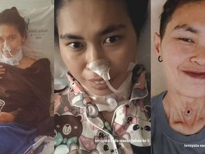 Cerita Wanita Salatiga Kena Kanker Laring Stadium 3, Sempat Dikira Radang Tenggorokan Cerita Wanita Salatiga Kena Kanker Laring Stadium 3, Sempat Dikira Radang Tenggorokan