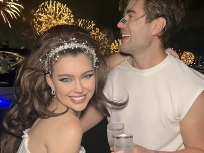 Foto Pasangan yang Terobsesi Oplas, Habiskan Rp 570 Juta Tapi Belum Puas