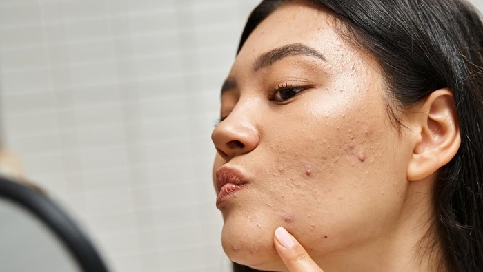 Ilustrasi Bahaya Skincare Mengandung Merkuri