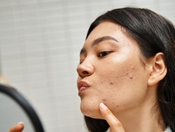 Cara Mengatasi Jerawat di Usia 40-an, Ini Skincare Routine yang Aman & Efektif Cara Mengatasi Jerawat di Usia 40-an, Ini Skincare Routine yang Aman & Efektif
