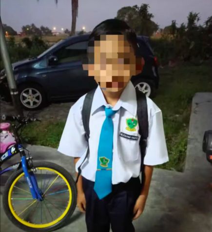Tersedak Permen 'Bola Mata', Bocah Ini Berakhir di ICU