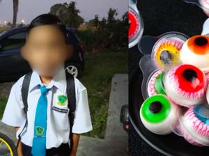 Tersedak Permen Bola Mata, Bocah Ini Dilarikan ke ICU Tersedak Permen Bola Mata, Bocah Ini Dilarikan ke ICU