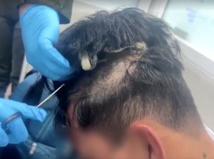 Video: Ada-ada Saja, Pria Ini Sembunyikan Narkoba di Balik Rambut Palsu