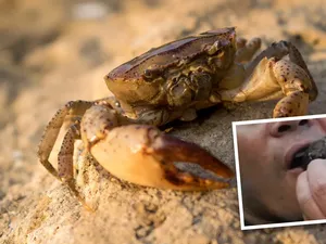 Bocah Ini Dirawat Usai Terjangkit Parasit Gegara Makan Kepiting Mentah