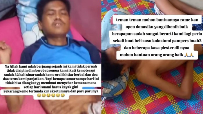 Kisah pengidap kanker rektum di Simalungun, Sumatera Utara.