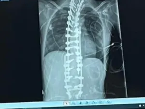 Tak Mudah Jadi Annie yang Tak Bisa Makan Apapun 10 Tahun Terakhir