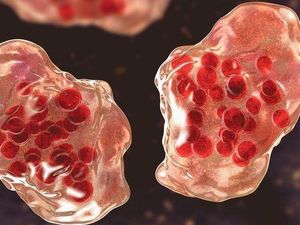 Campak Hantui Negara Tetangga RI, Gimana Cara Efektif Menanganinya?