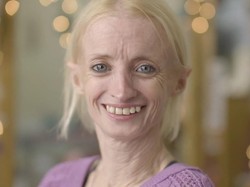 Kisah Pilu Wanita yang Menua Sebelum Waktunya gegara Kelainan Genetik