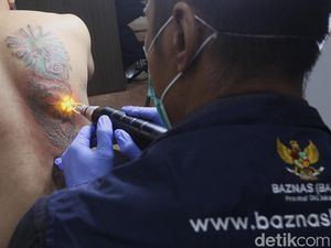Layanan Gratis Hapus Tato Saat Ramadan