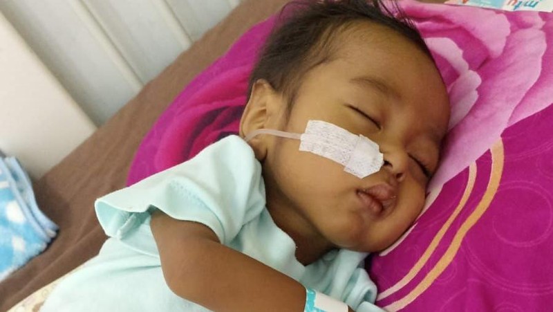 Kisah Pilu Castiel, Bayi Penderita Tumor Hati yang Berjuang Sembuh