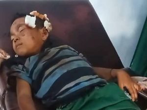 Bocah SD di Dompu Digigit Anjing Rabies, Jari Putus dan Telinga Robek