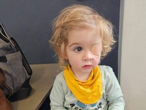 Bocah 2 Tahun Buta Sebelah usai Tertular Herpes, Diduga gegara Dicium Orang Lain Bocah 2 Tahun Buta Sebelah usai Tertular Herpes, Diduga gegara Dicium Orang Lain