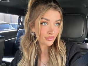 Kontroversi Putri Charlie Sheen, Baru Usia 21 Sudah Oplas Payudara dan Hidung Kontroversi Putri Charlie Sheen, Baru Usia 21 Sudah Oplas Payudara dan Hidung