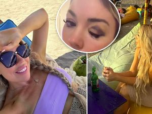 Liburan Singkat di Bali, Turis Pingsan Lalu Bangun dengan Mata Lebam