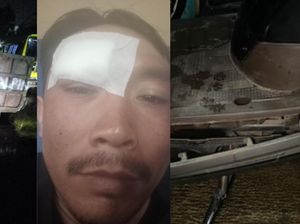 Gegara Jalan Gelap, Driver Ojol di Bandung Tabrak Truk Sampah Gegara Jalan Gelap, Driver Ojol di Bandung Tabrak Truk Sampah