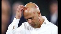 Setelah disingkirkan PSG dari Liga Champions, Liverpool dikalahkan Newcastle United di final Carabao Cup. Sirna pula kans Arne Slot meraih piala di ajang-ajang itu, Foto: dok. Internet/X (Twitter)