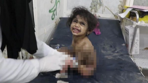 Miris, Anak-anak Jadi Korban Serangan Udara AS di Yaman