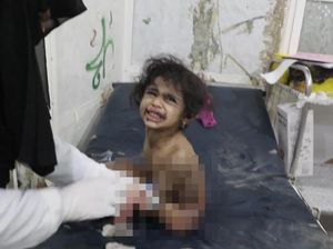 Miris, Anak-anak Jadi Korban Serangan Udara AS di Yaman