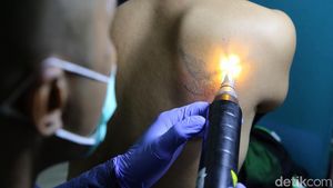 Ratusan Orang Ikut Hapus Tato Gratis di Kantor Walikota Jakarta Timur