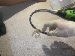 Keluhan Remaja Wonogiri Nyeri Saat Pipis Tuntas Ditangani Damkar