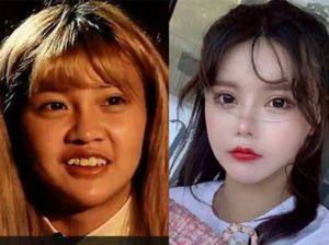 Influencer China Operasi Hidung Demi Mancung, Endingnya Malah Susah Napas