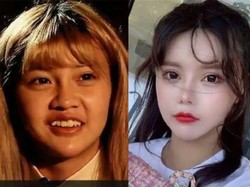 Influencer China Operasi Hidung Demi Mancung, Endingnya Malah Susah Napas