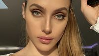 Foto: Kondisi Model OnlyFans yang Hilang Ingatan Setelah Kecelakaan Motor