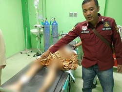 Diduga Tolak Rujuk Jadi Alasan Suami di Lubuklinggau Aniaya Istri