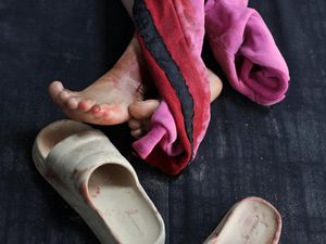 Video Pilu Ibu di Gaza Takut Kehilangan Anaknya Gegara Krisis Perawatan Medis