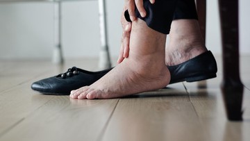 Jangan Anggap Sepele! Tanda-tanda Jantung Bermasalah yang Muncul di Kaki di Usia Muda