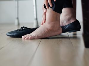 Tanda Jantung Bermasalah yang Bisa Muncul di Kaki, Usia Muda Wajib Waspada Tanda Jantung Bermasalah yang Bisa Muncul di Kaki, Usia Muda Wajib Waspada