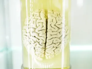 Otak Babi Bisa Bertahan Hidup 5 Jam di Luar Tubuhnya