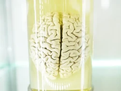 Otak Babi Bisa Bertahan Hidup 5 Jam di Luar Tubuhnya