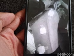 Kurir Paket Ditusuk Begal di Jalan Cimindi, HP Dibawa Kabur