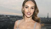 Foto: Artis yang Jadi Korban Air Keras Pamer Skin Confidence