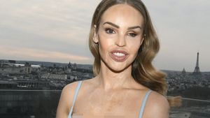 Foto: Artis yang Jadi Korban Air Keras Pamer Skin Confidence