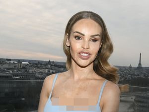 Artis Korban Air Keras Jalani 400 Oplas, Sakit Hati Dituduh Kebanyakan Botox Artis Korban Air Keras Jalani 400 Oplas, Sakit Hati Dituduh Kebanyakan Botox