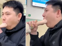 Momen Kocak Tangan Wanita Tersangkut di Mulut Pacar, Berakhir Dilarikan ke RS