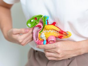 Nyaris 100 Batu Empedu Dikeluarkan dari Perut Wanita China, Ini Jadi Biang Keroknya Nyaris 100 Batu Empedu Dikeluarkan dari Perut Wanita China, Ini Jadi Biang Keroknya