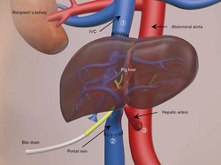 Ilmuwan China Transplantasi Hati Babi ke Manusia, Hidup 171 Hari!
