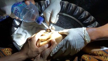    Damkar Tarakan Ungkap Kisah Tak Biasa: Evakuasi Cincin dari Jari Almarhum!   Pertama Kali Terjadi! Damkar Tarakan Turun Tangan Evakuasi Cincin di Jasad.   Antara Hidup dan Mati: Dramatisnya Damkar Tarakan Lepaskan Cincin dari Jenazah.   Bukan Hanya Api, Damkar Tarakan Juga Selamatkan