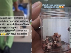 Viral Wanita di Jateng Ngeluh Sakit Kepala, Tak Tahunya Kena Tumor Otak