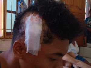 Pelajar Dikeroyok-Dibacok di Puncak Waringin Labuan Bajo, Kepala-Bahu Luka