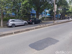 Mahasiswa UPI Harus Operasi Rahang gegara Lubang Jalan di Dago