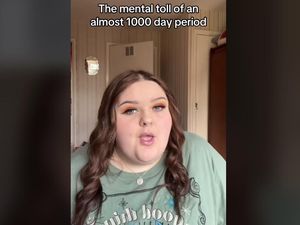 Punya Bentuk Rahim yang Berbeda Picu Wanita Ini Haid Lebih dari 1.000 Hari