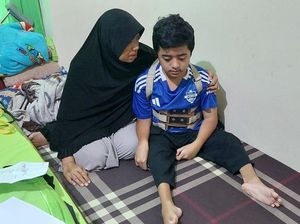 Yuk Bantu Kiki, Remaja Penderita Tulang Rapuh yang Sudah 16 Kali Operasi