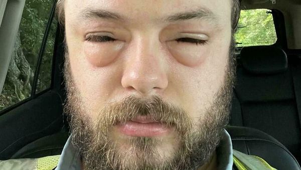 Kumpulan Foto yang Gambarkan Hari Sial Seseorang, Kasihan...