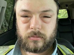 Kumpulan Foto yang Gambarkan Hari Sial Seseorang, Kasihan... Kumpulan Foto yang Gambarkan Hari Sial Seseorang, Kasihan...