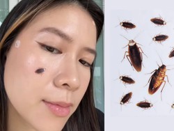 Bikin Merinding! Ada Acne Patch Bentuk Kecoa, Tampilannya Realistis